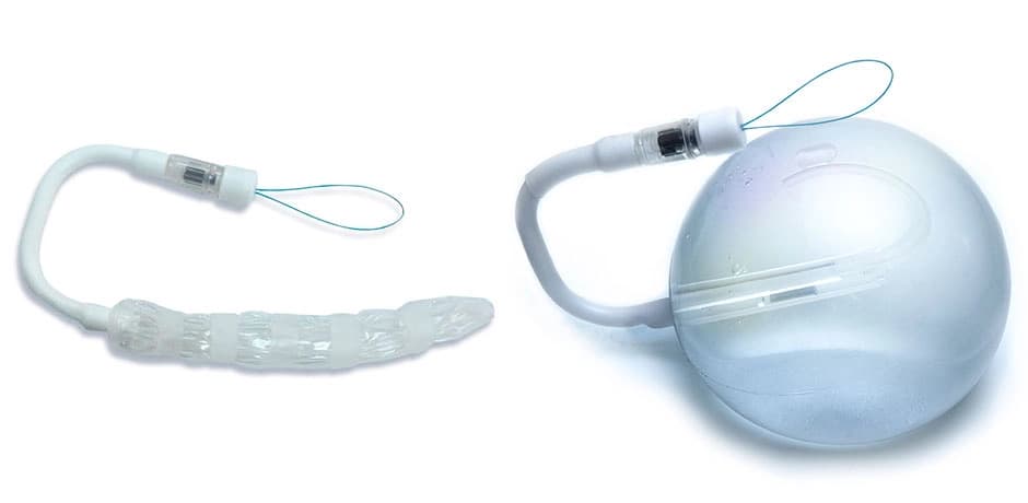 Ilustración de Balón Gástrico